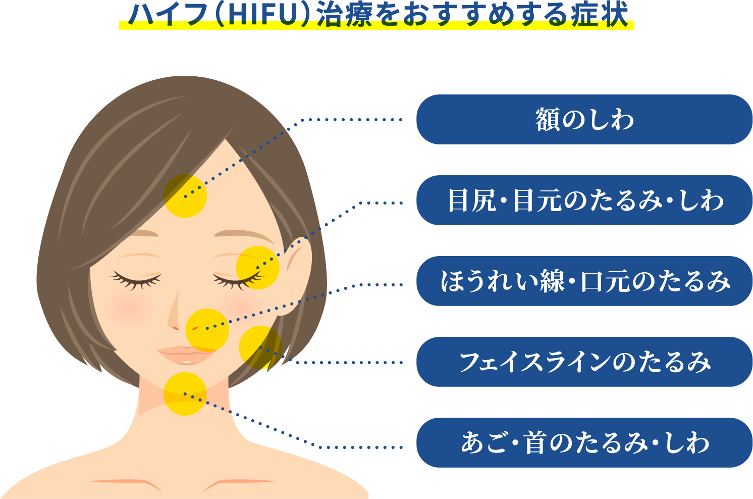ハイフ(HIFU)治療をお勧めする症状 額のしわ 目尻・目元のたるみ・しわ ほうれい線・口元のたるみ フェイスラインのたるみ あご・首のたるみ・しわ